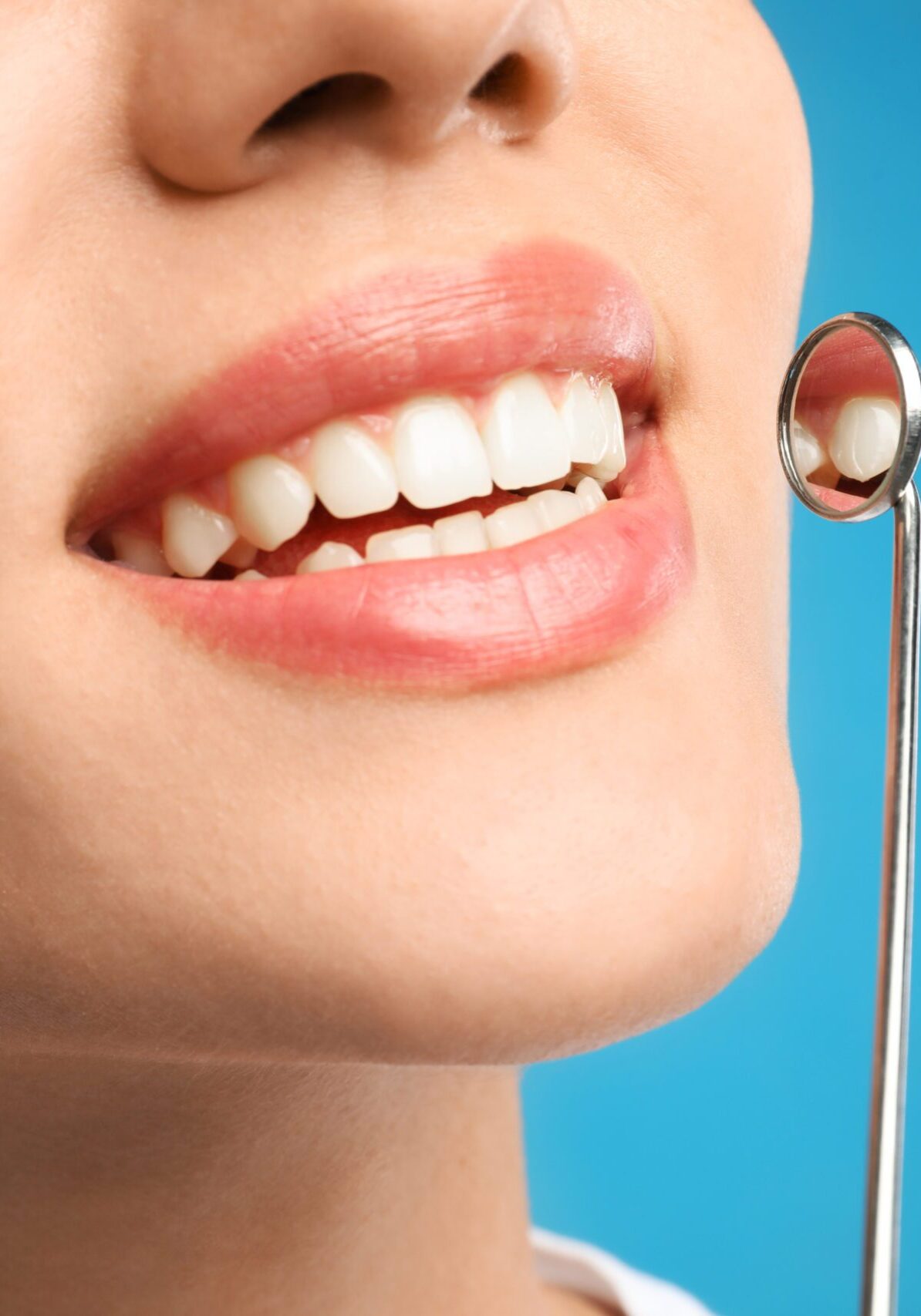 Young woman with mouth mirror on blue background, closeup. Cosme Best Dental Exam in Toronto