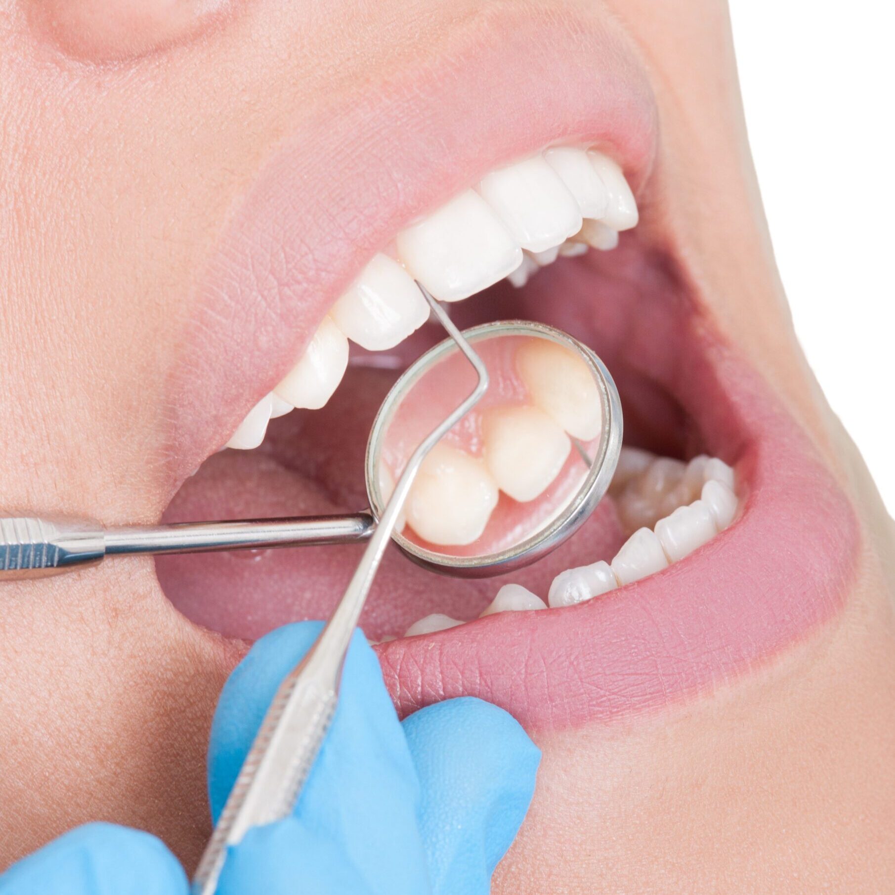 Dentist tools and perfect teeth Dentist tools and perfect teeth on white background