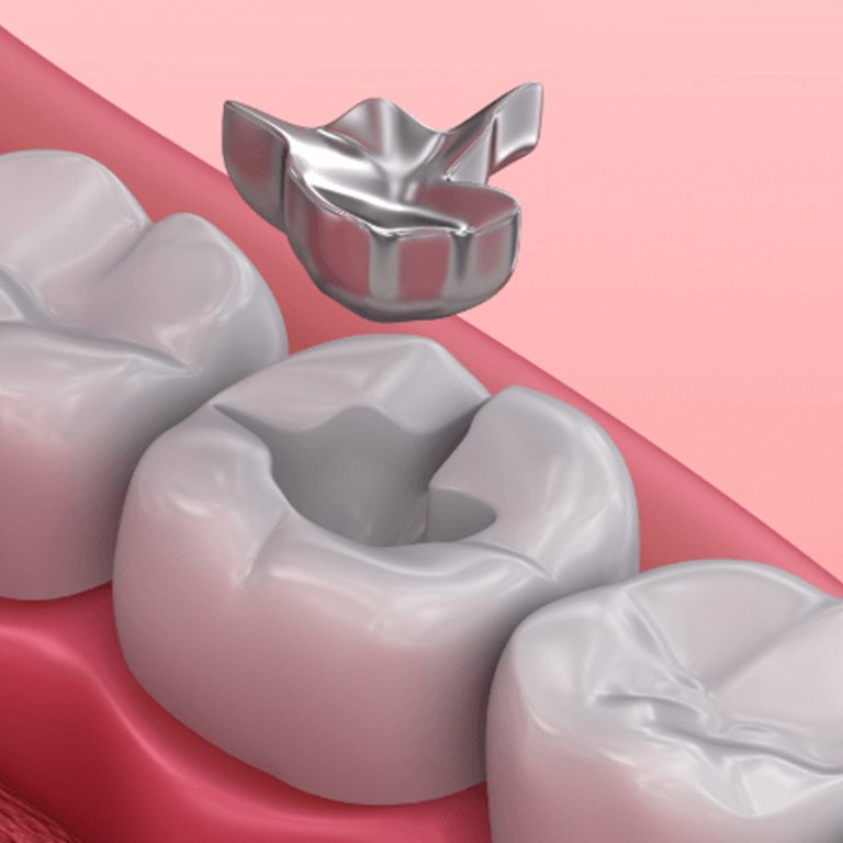 General Dentistry in One Yonge Street Toronto | One Yonge Dental Clinic Toronto